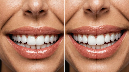 teeth whitening naturally